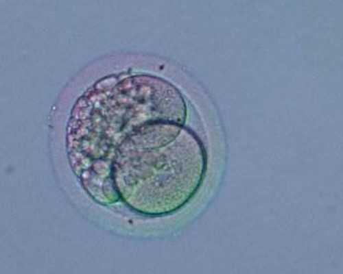 广东做供卵试管哪家好,泰国试管婴儿攻略：5大方法，养出高质量卵子泰国试管