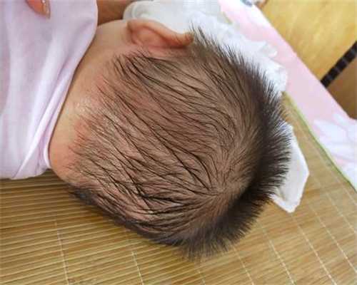 澳门试管代孕供卵费用_孕期吃糖多会有问题吗？