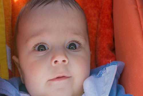 澳门诚信代孕中心-割双眼皮大概几毫米